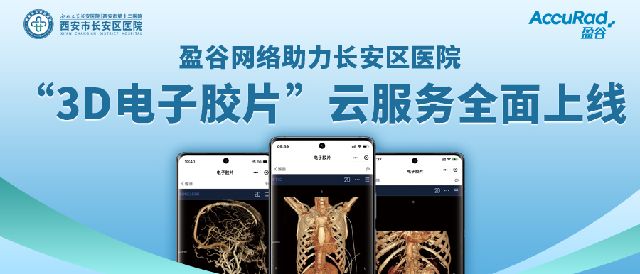 盈谷網(wǎng)絡(luò)助力長安區(qū)醫(yī)院“3D電子膠片”云服務(wù)全面上線！診斷結(jié)果、影像資料隨時隨地看！